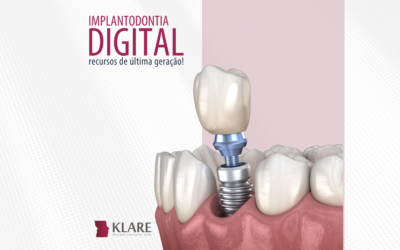 Implantodontia Digital – recursos de última geração!