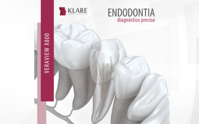 Endodontia – diagnóstico preciso.