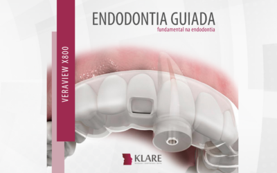 Endontia Guiada – fundamental na endodontia.