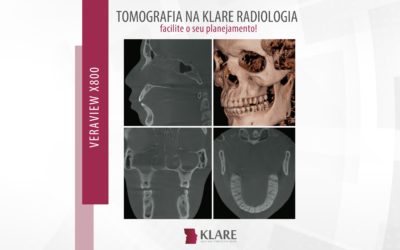 Tomografia na Klare Radiologia – facilite o seu planejamento!