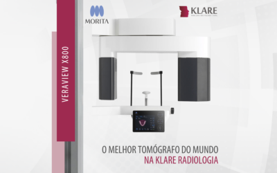 O melhor tomógrafo do mundo na Klare Radiologia