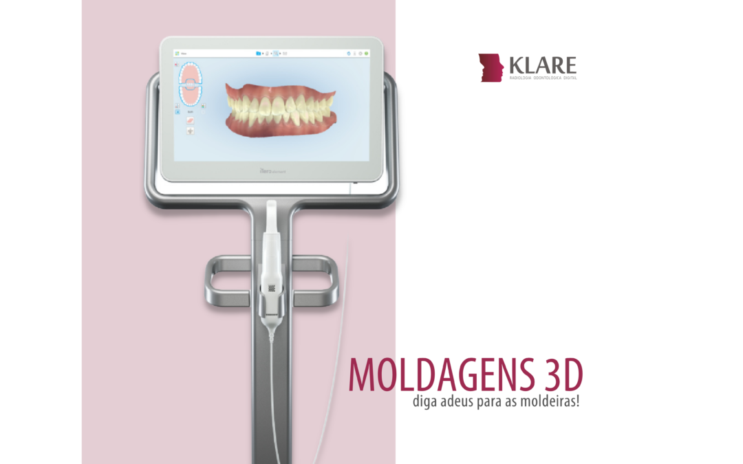 arcada dentária visualizada por scanner