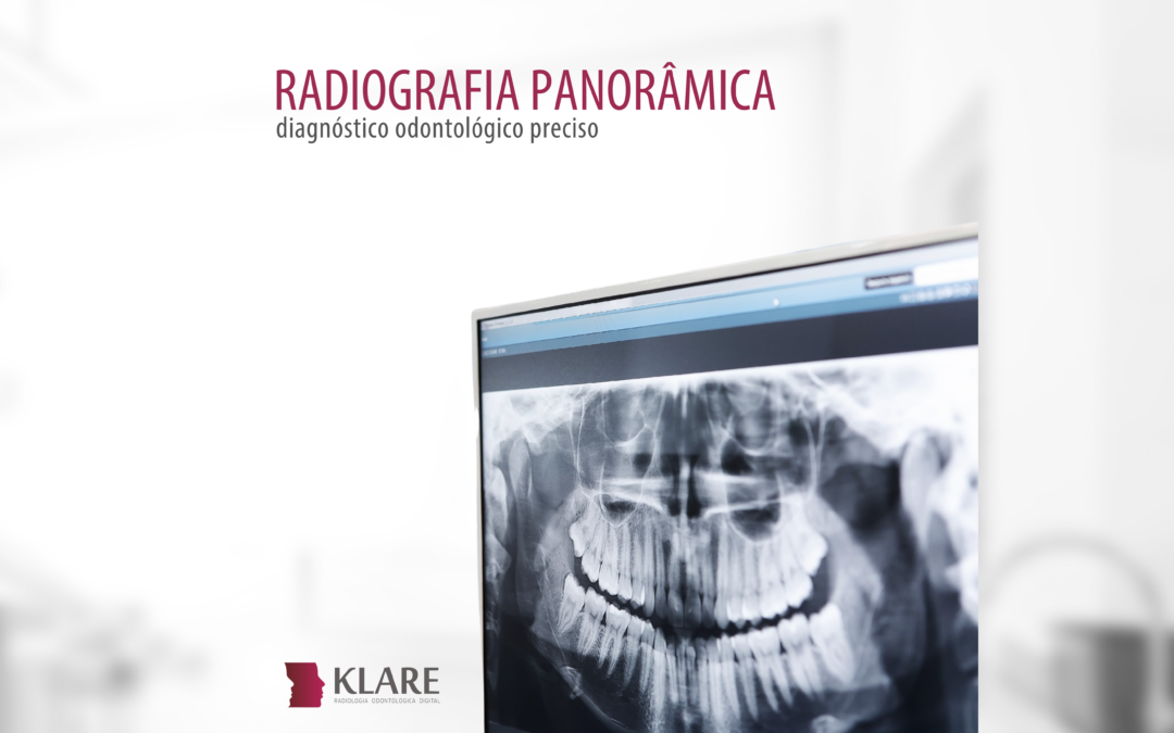 Radiografia panorâmica