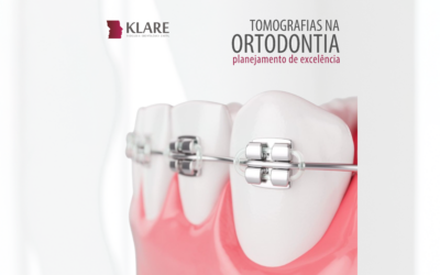 Tomografias na Ortodontia – planejamento de excelência.