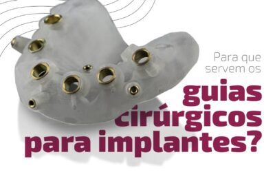 Guias cirúrgicos para implantes